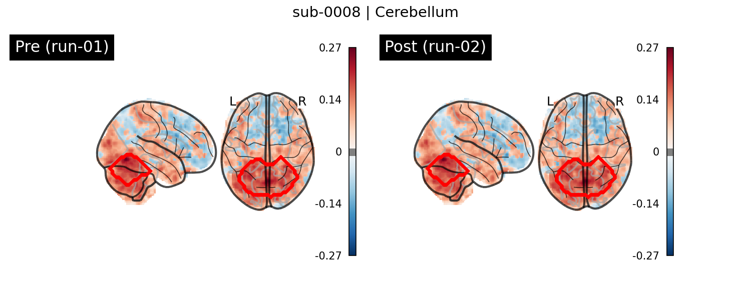 sub-0008_Cerebellum_run-comparison.png
