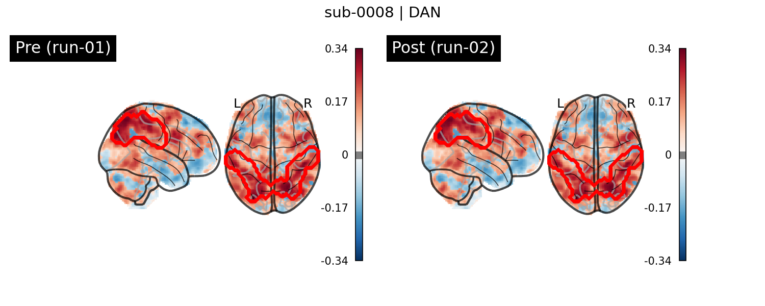 sub-0008_DAN_run-comparison.png