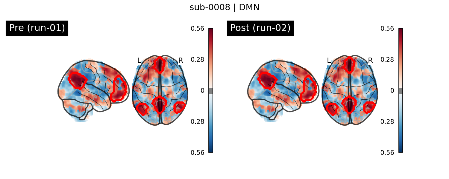 sub-0008_DMN_run-comparison.png