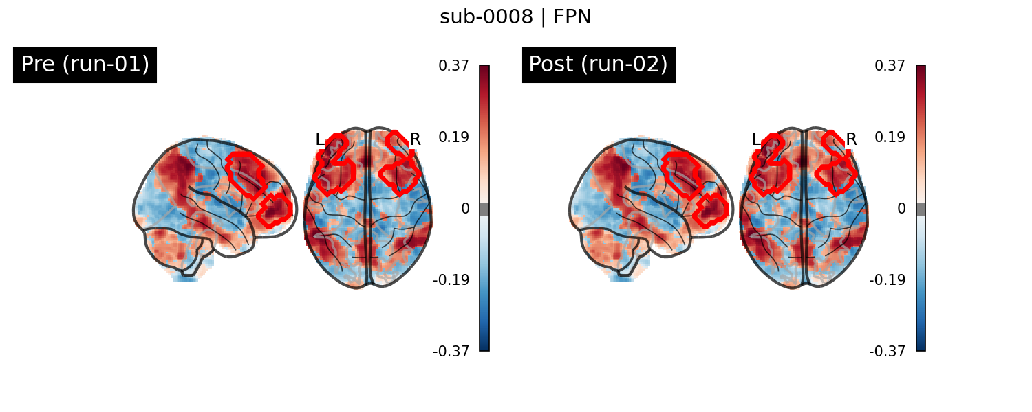 sub-0008_FPN_run-comparison.png