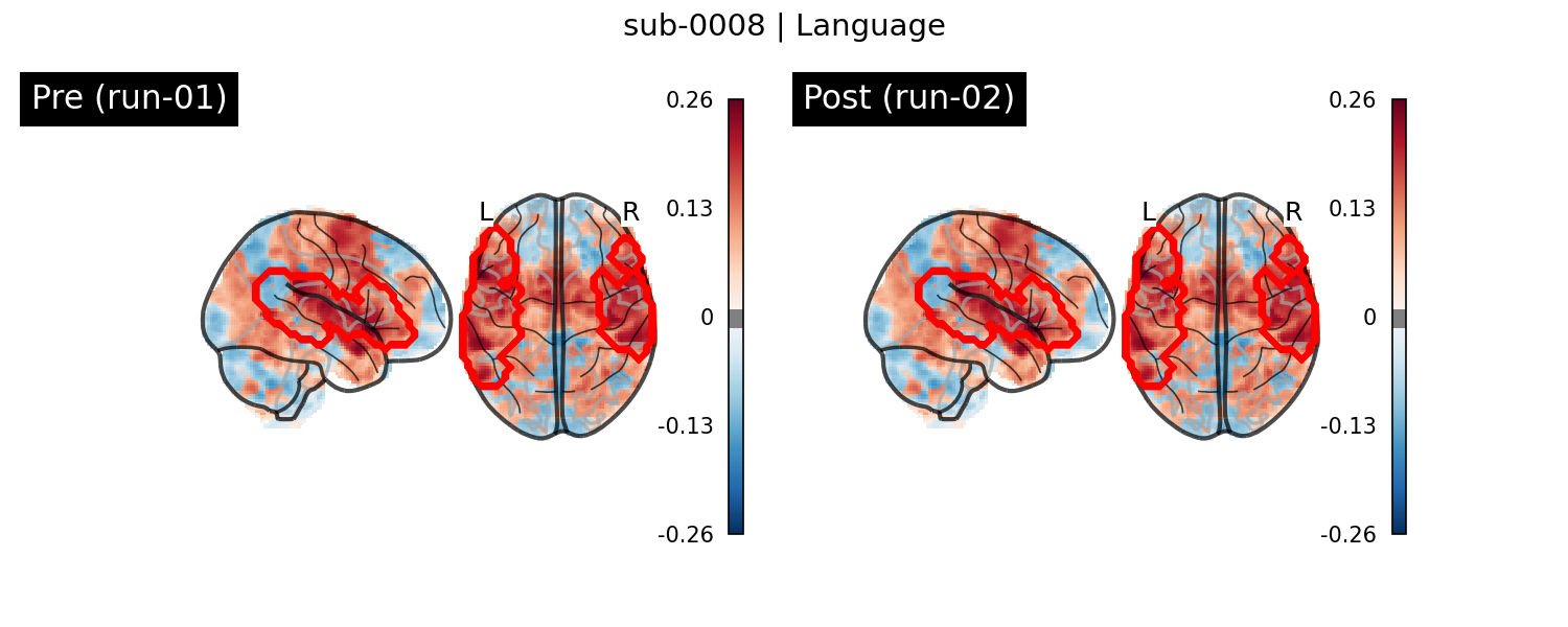 sub-0008_Language_run-comparison.png