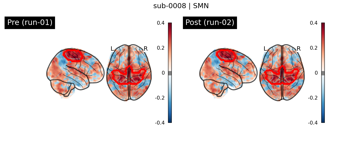sub-0008_SMN_run-comparison.png