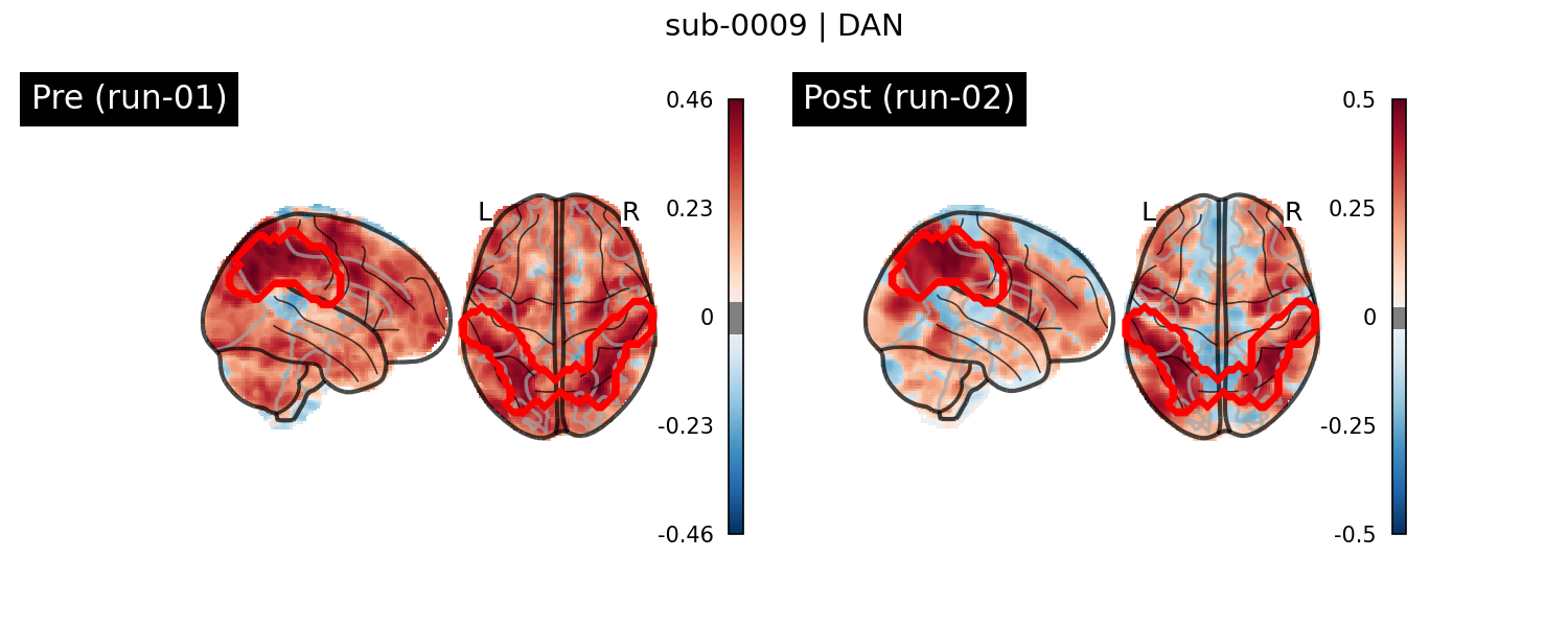 sub-0009_DAN_run-comparison.png