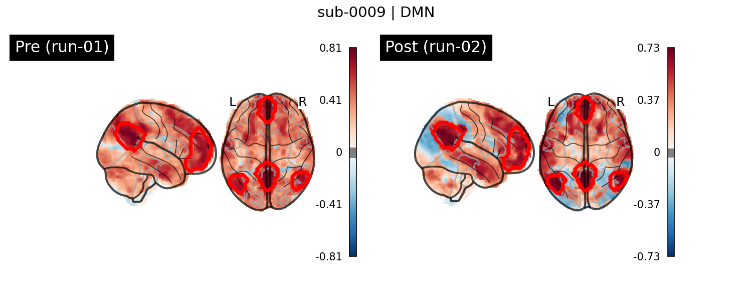 sub-0009_DMN_run-comparison.png