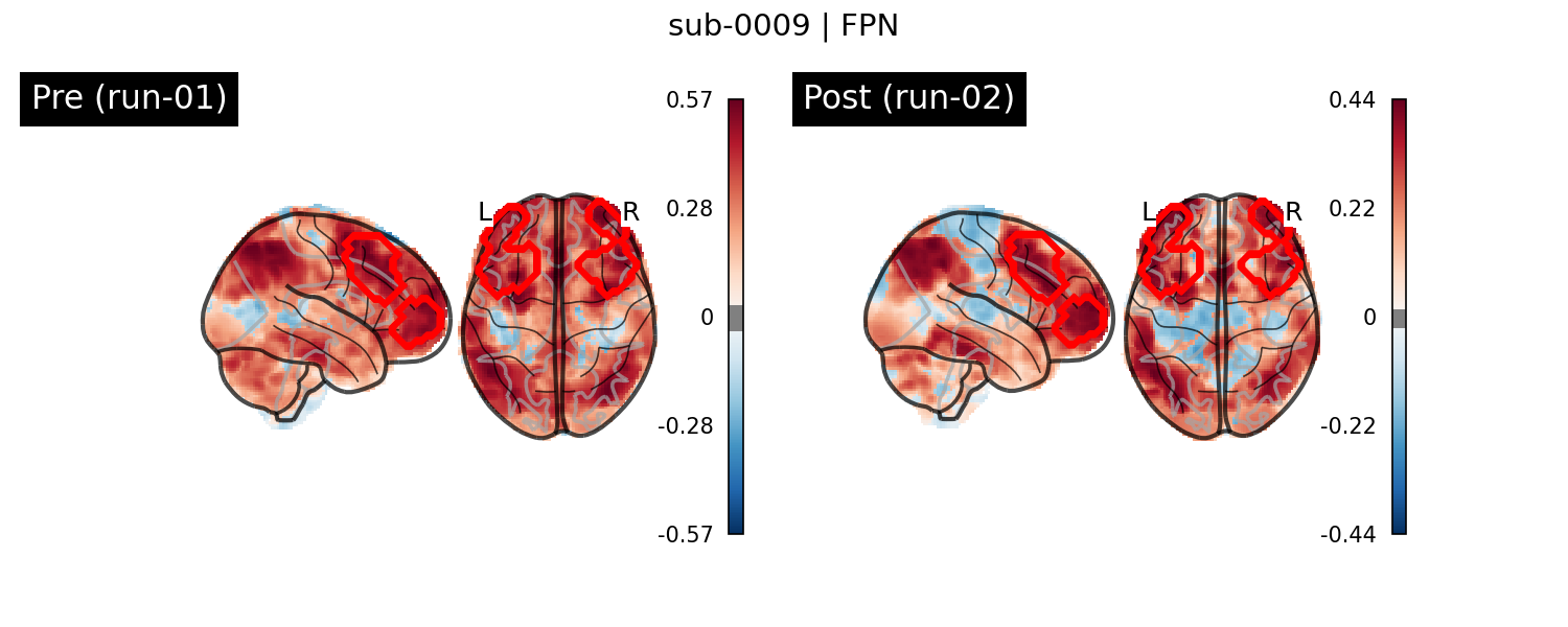 sub-0009_FPN_run-comparison.png