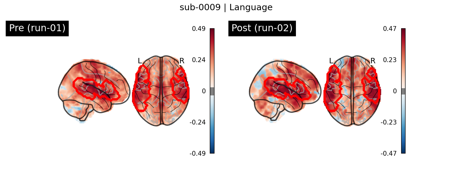 sub-0009_Language_run-comparison.png