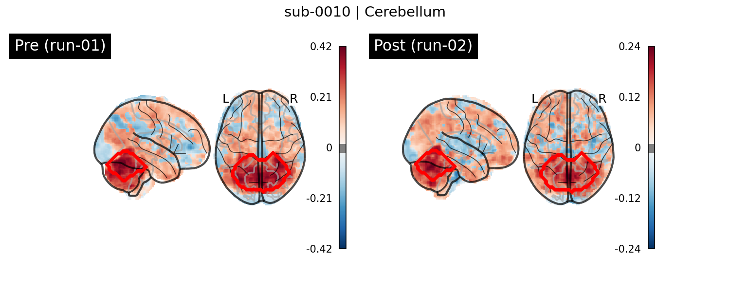 sub-0010_Cerebellum_run-comparison.png
