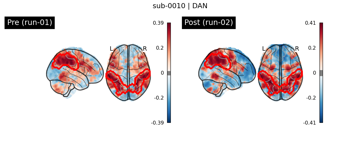 sub-0010_DAN_run-comparison.png