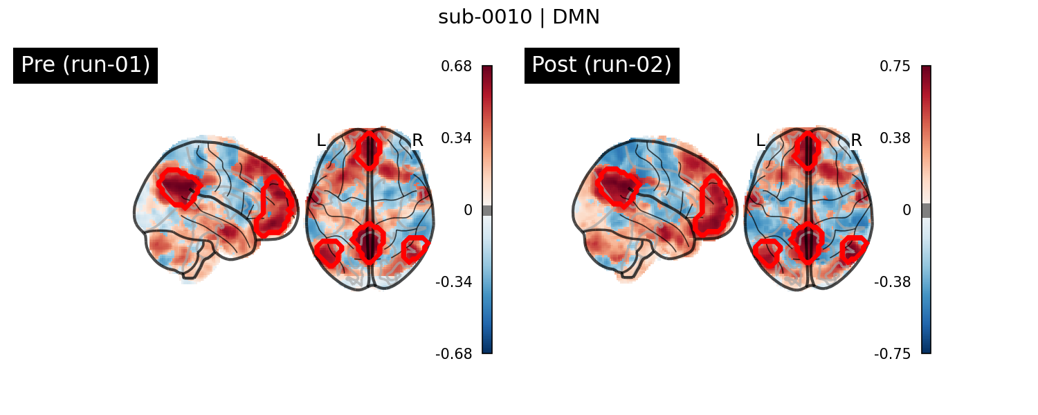 sub-0010_DMN_run-comparison.png