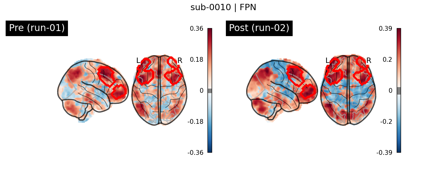 sub-0010_FPN_run-comparison.png