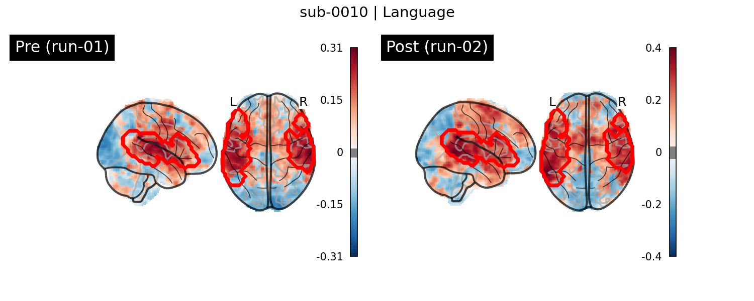 sub-0010_Language_run-comparison.png
