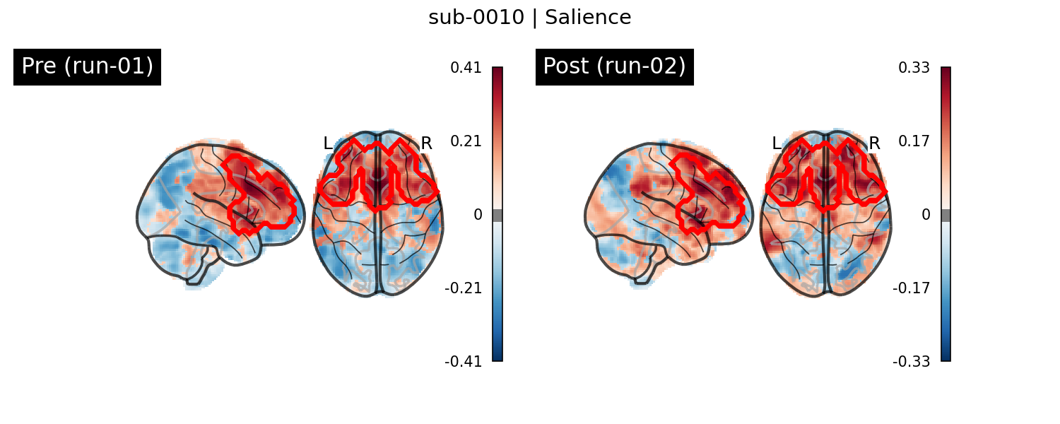 sub-0010_Salience_run-comparison.png