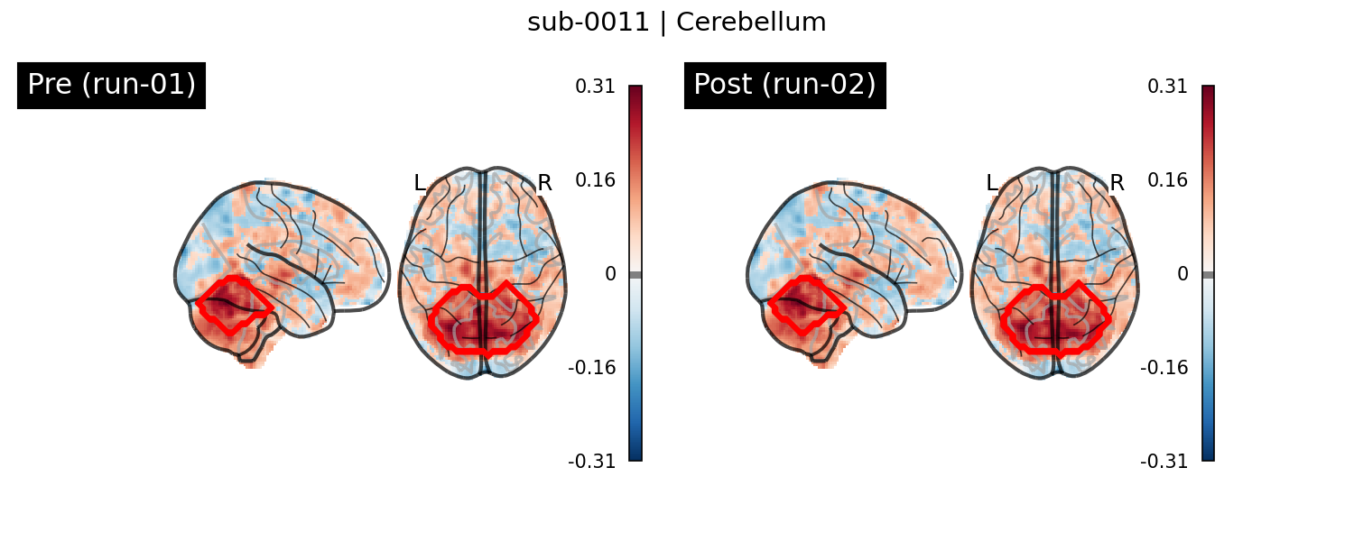 sub-0011_Cerebellum_run-comparison.png