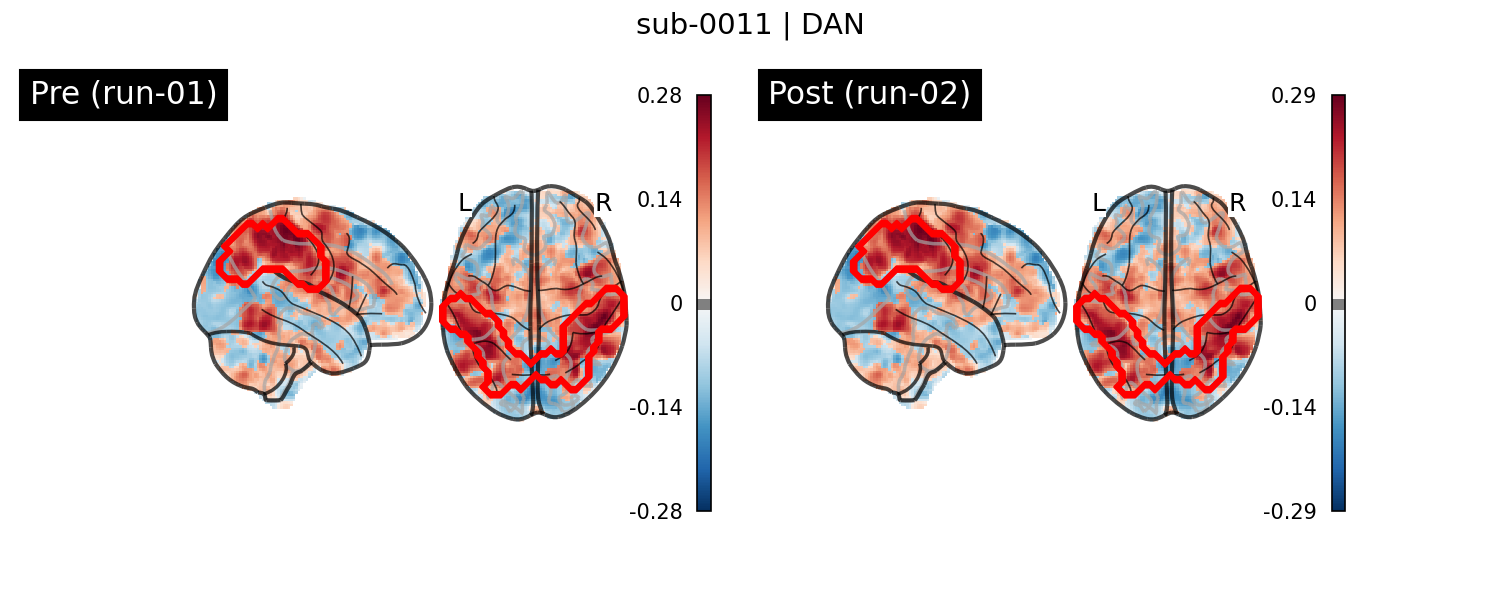 sub-0011_DAN_run-comparison.png
