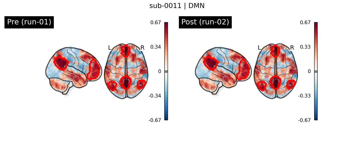 sub-0011_DMN_run-comparison.png