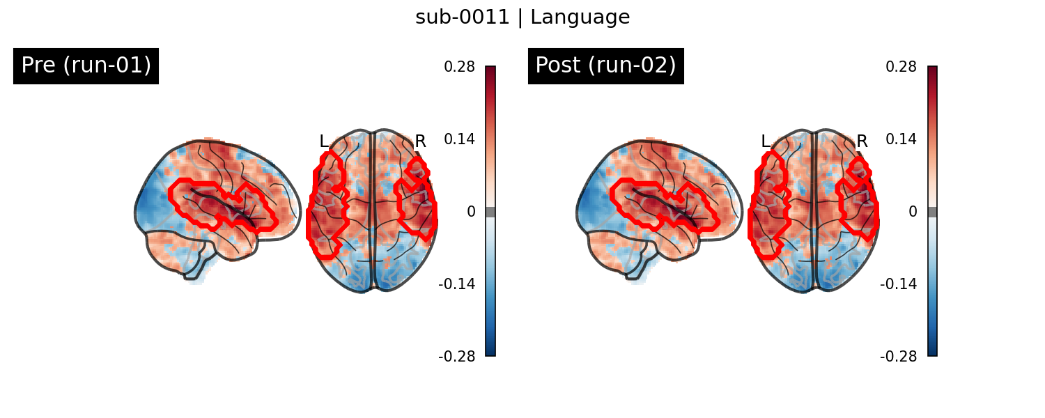 sub-0011_Language_run-comparison.png