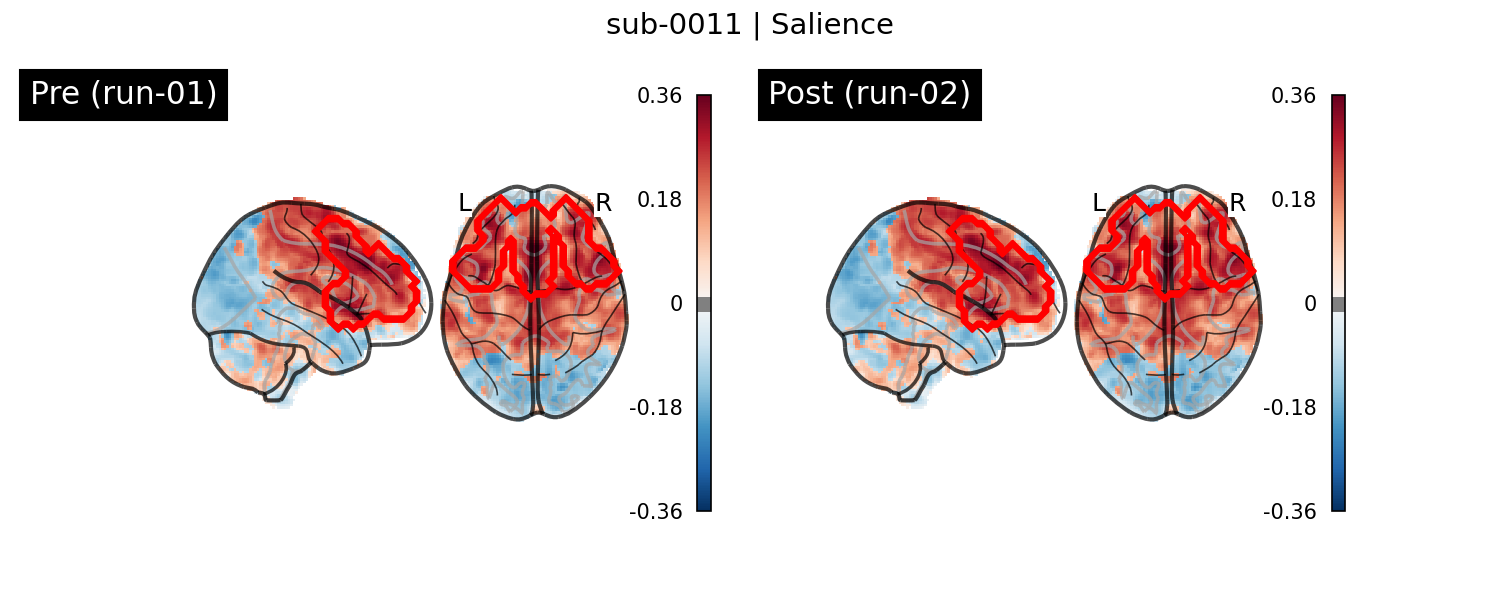 sub-0011_Salience_run-comparison.png