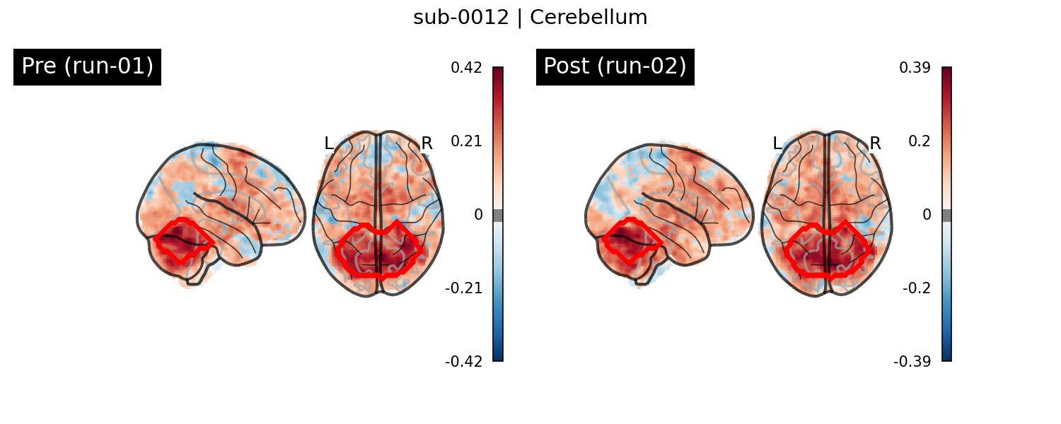 sub-0012_Cerebellum_run-comparison.png