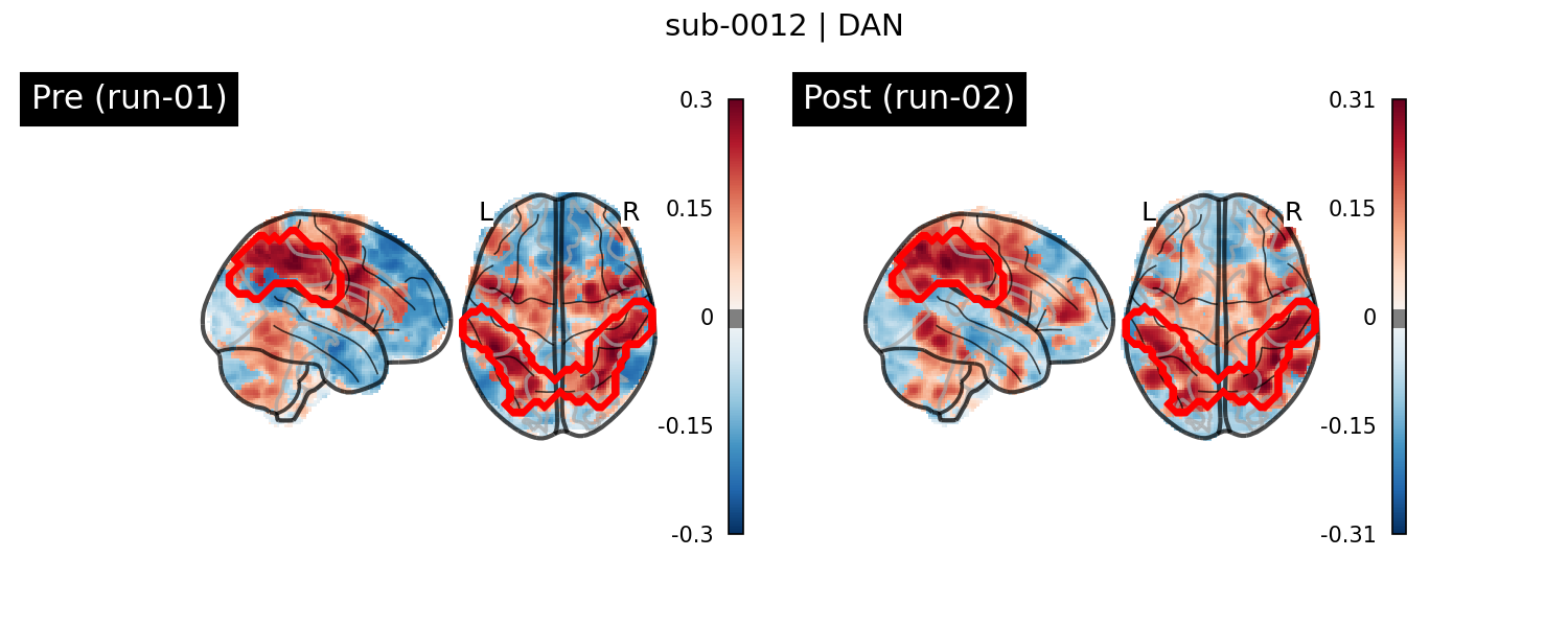 sub-0012_DAN_run-comparison.png