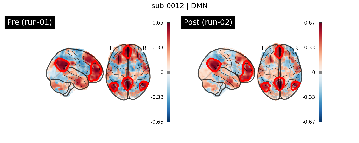 sub-0012_DMN_run-comparison.png