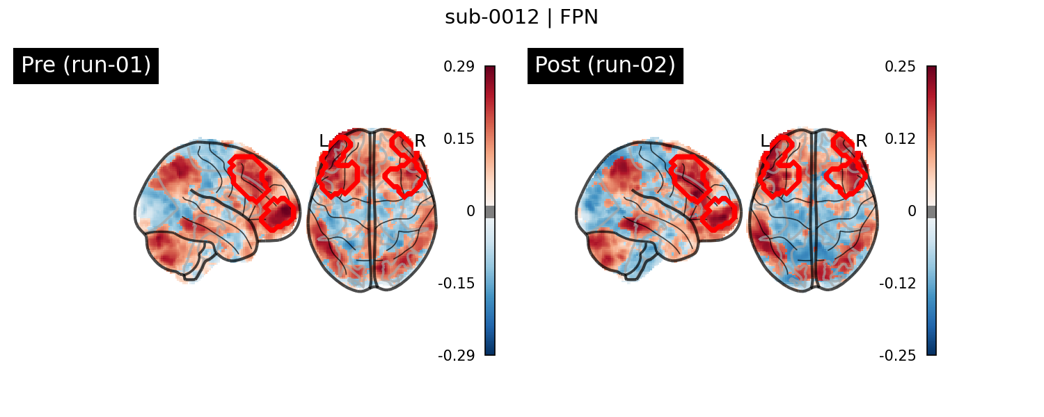 sub-0012_FPN_run-comparison.png