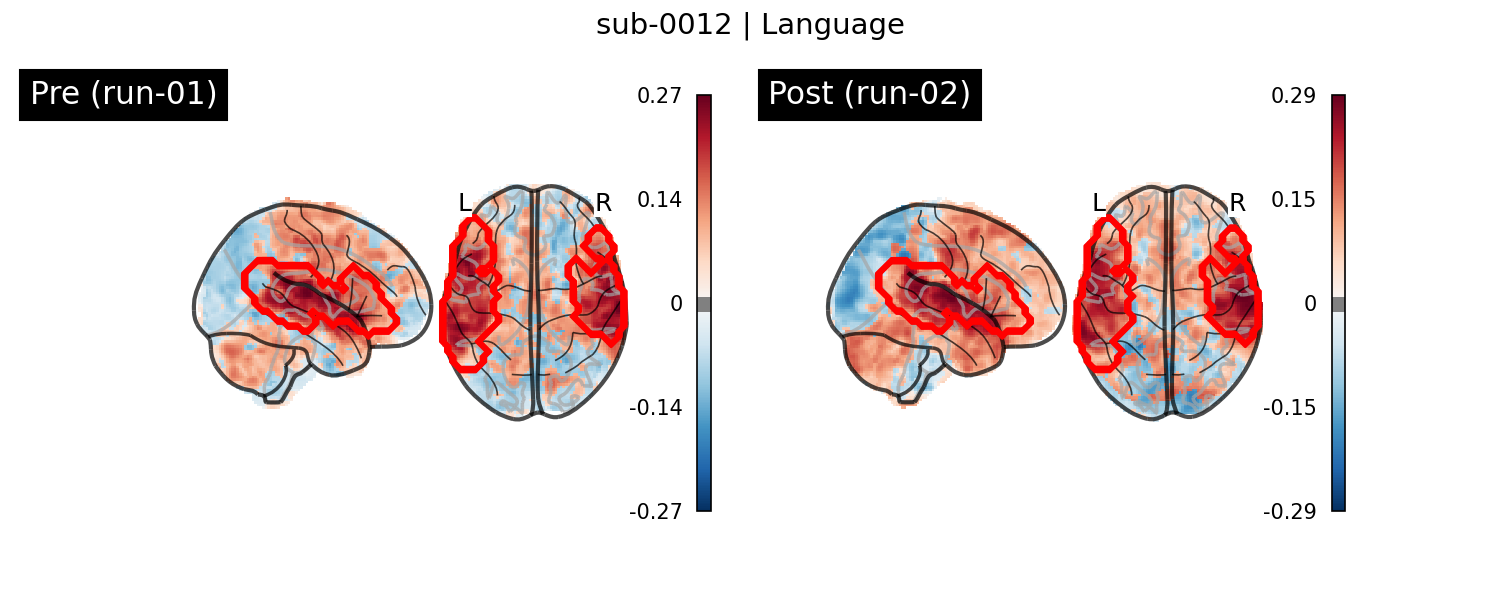 sub-0012_Language_run-comparison.png