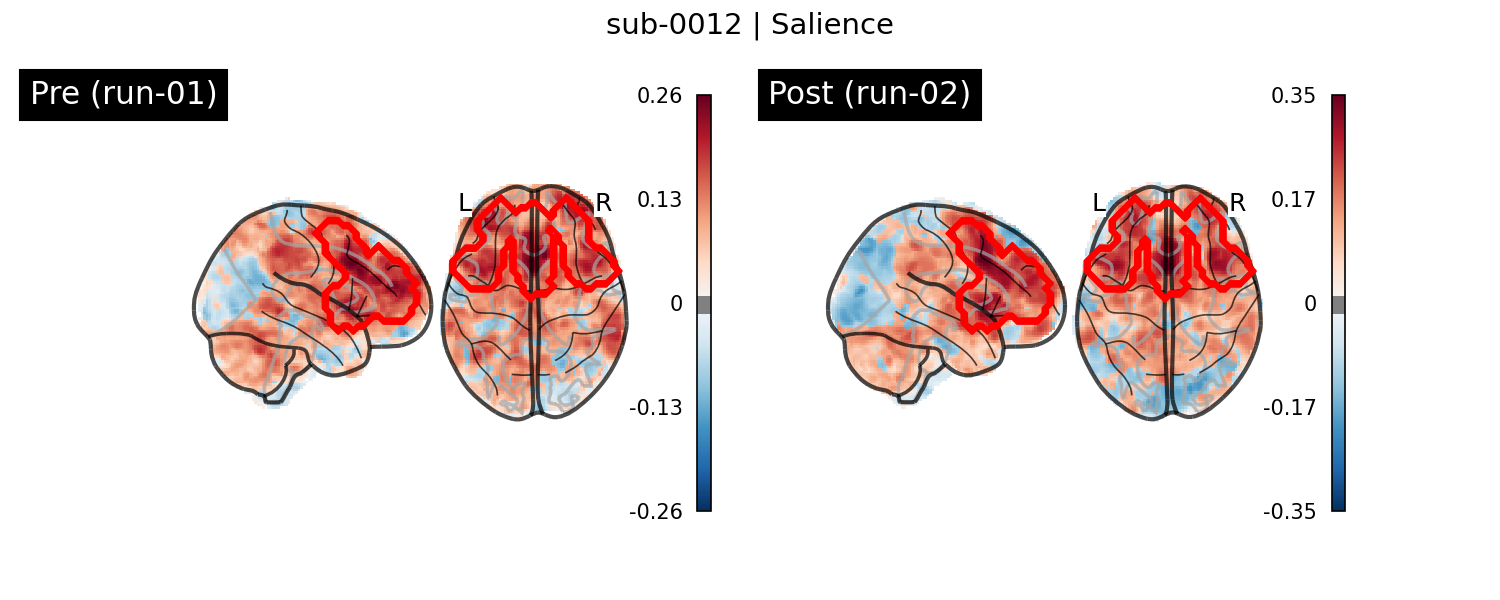 sub-0012_Salience_run-comparison.png