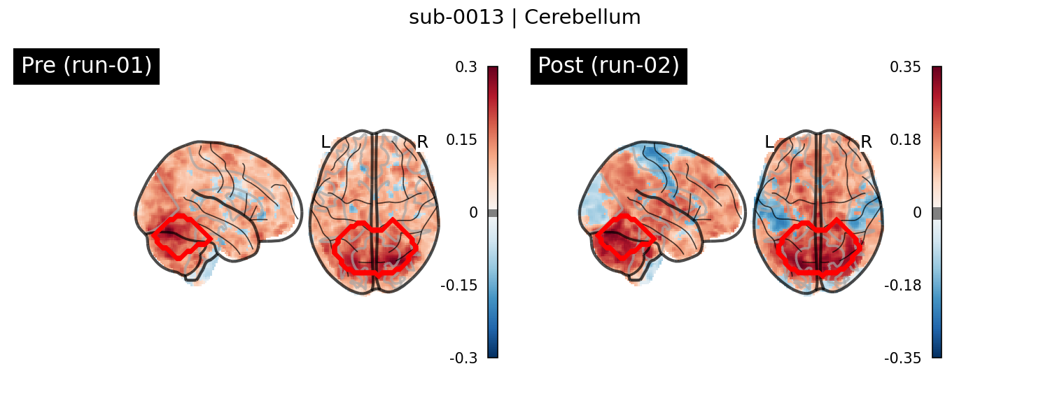 sub-0013_Cerebellum_run-comparison.png