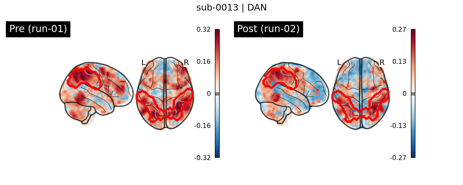 sub-0013_DAN_run-comparison.png