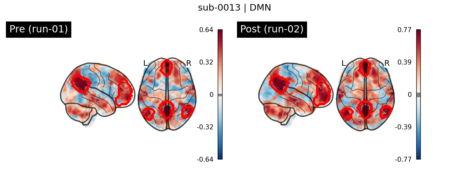 sub-0013_DMN_run-comparison.png