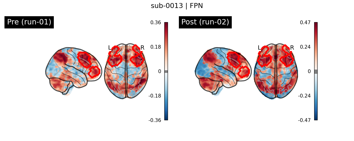 sub-0013_FPN_run-comparison.png