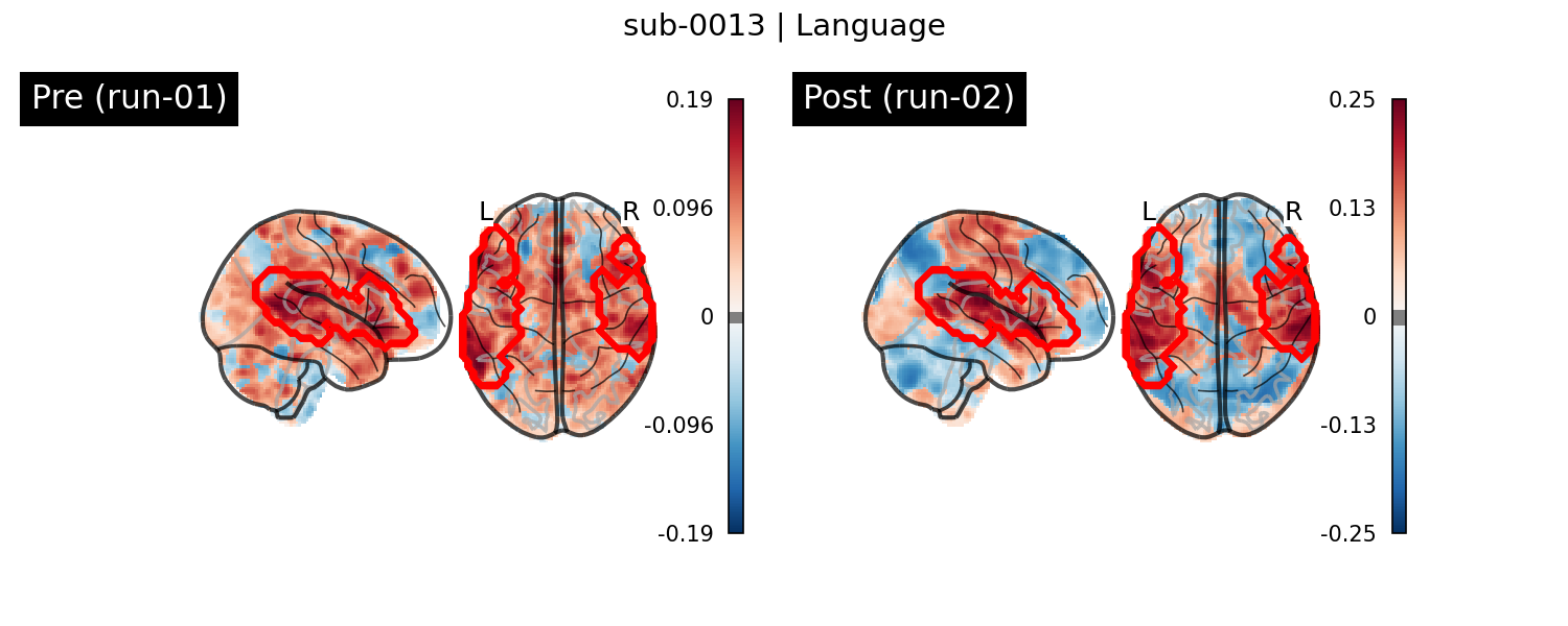 sub-0013_Language_run-comparison.png