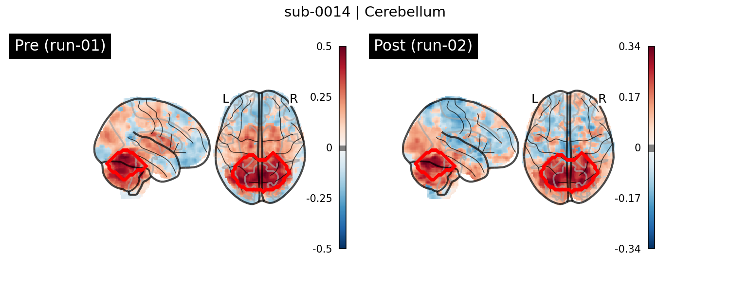 sub-0014_Cerebellum_run-comparison.png