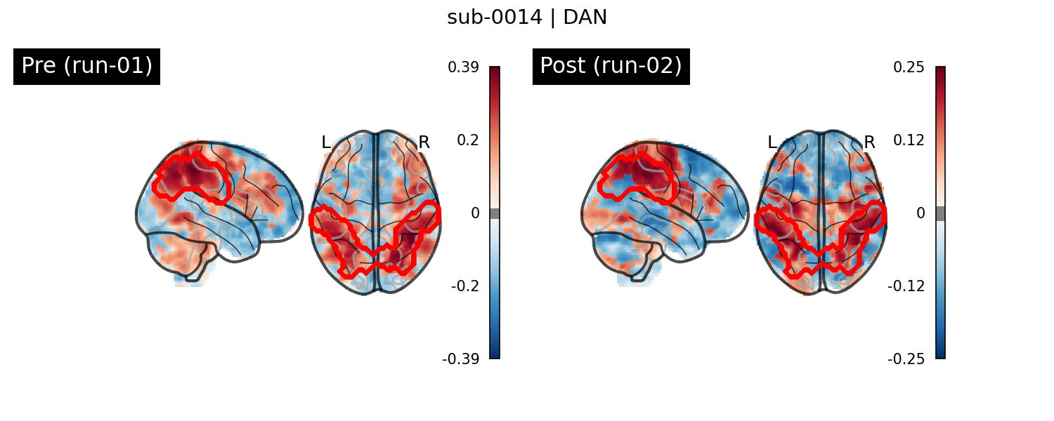 sub-0014_DAN_run-comparison.png