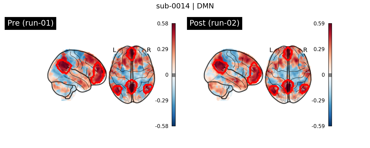 sub-0014_DMN_run-comparison.png