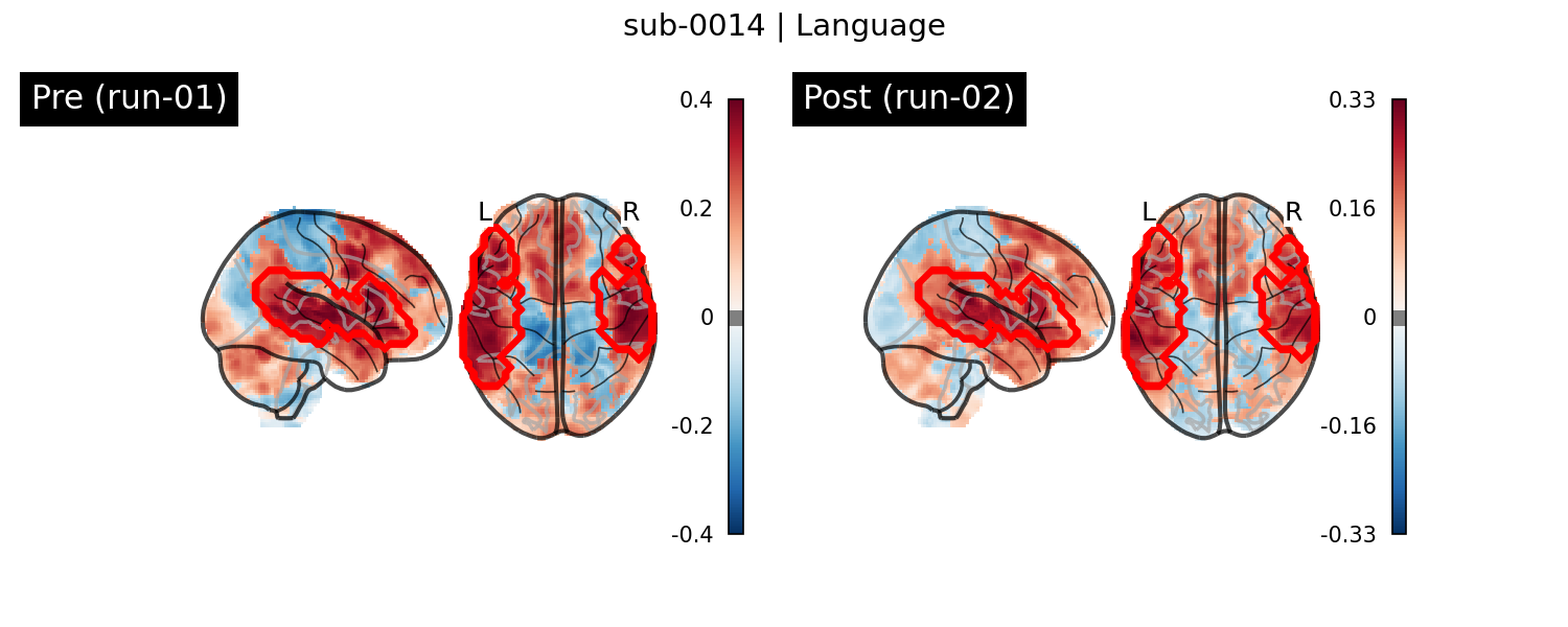 sub-0014_Language_run-comparison.png