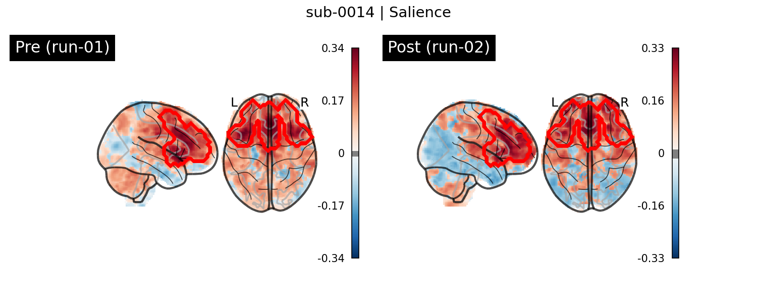 sub-0014_Salience_run-comparison.png