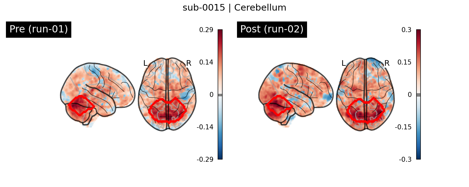 sub-0015_Cerebellum_run-comparison.png
