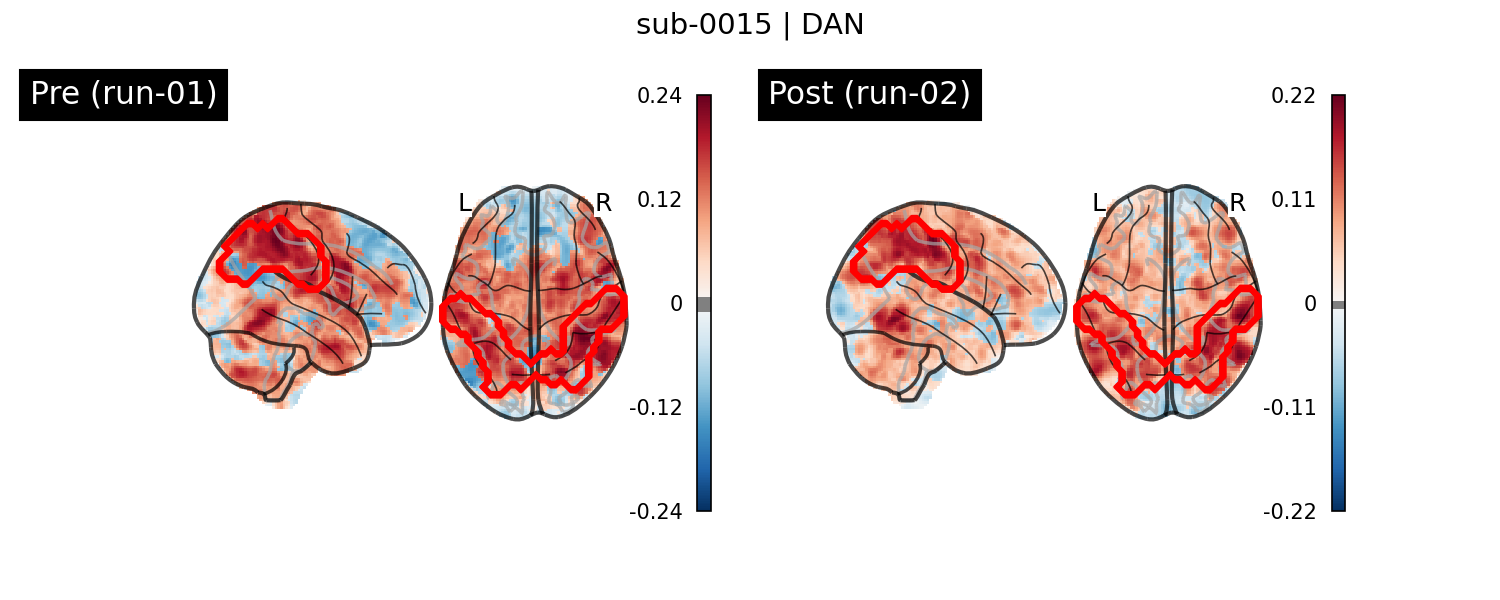 sub-0015_DAN_run-comparison.png