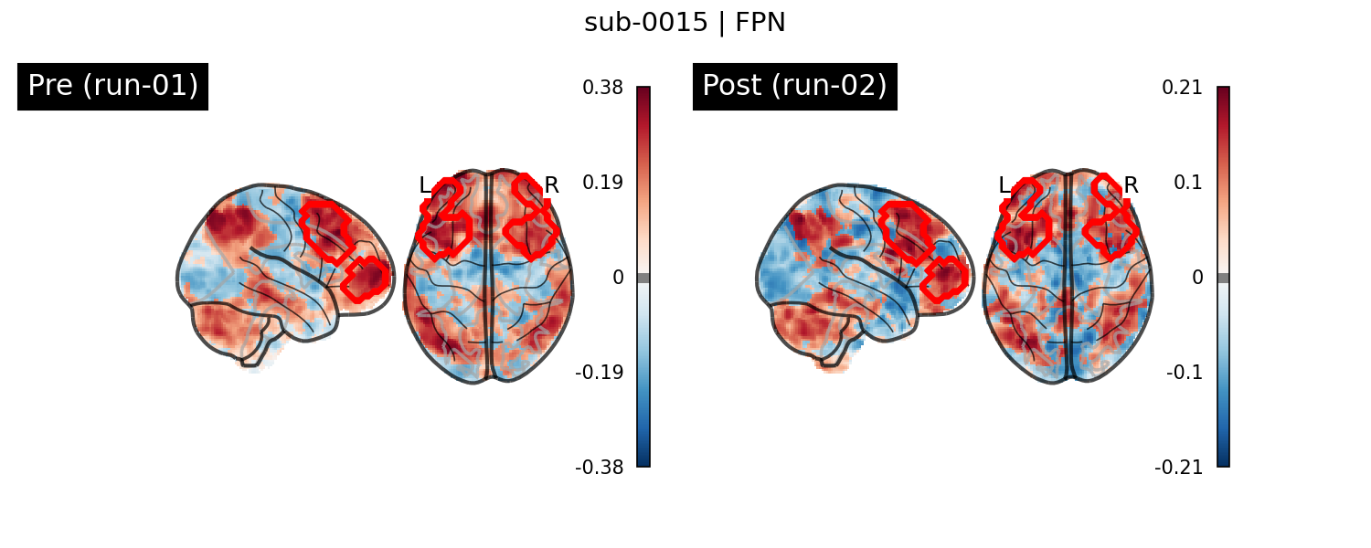 sub-0015_FPN_run-comparison.png