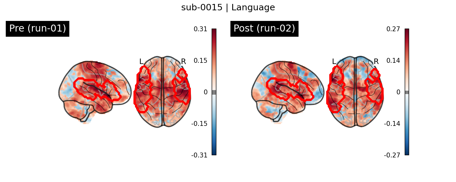 sub-0015_Language_run-comparison.png