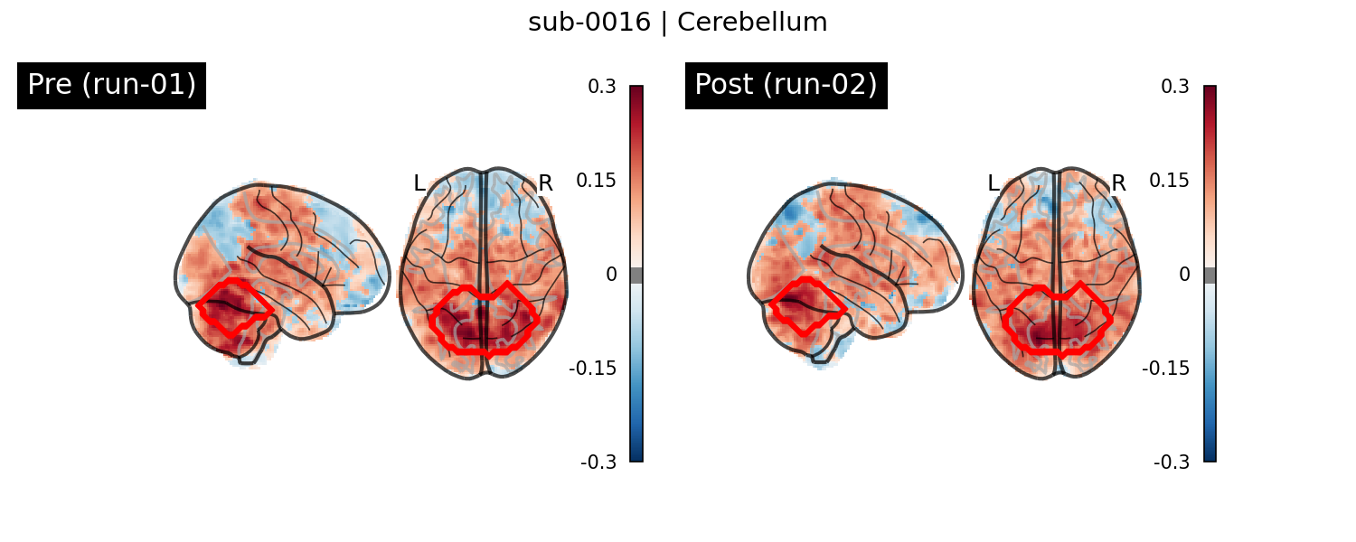sub-0016_Cerebellum_run-comparison.png