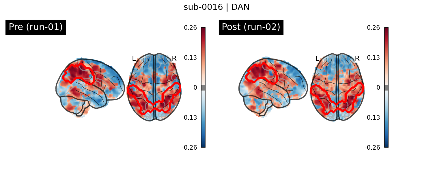 sub-0016_DAN_run-comparison.png