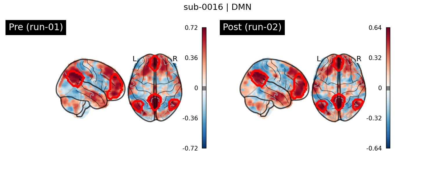 sub-0016_DMN_run-comparison.png