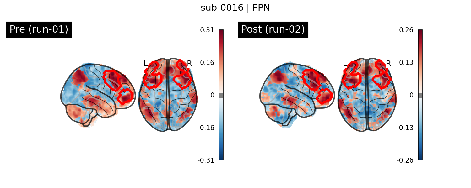 sub-0016_FPN_run-comparison.png