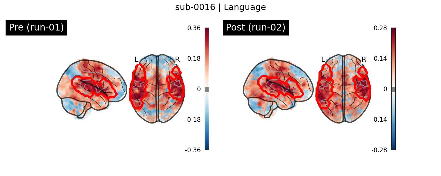 sub-0016_Language_run-comparison.png