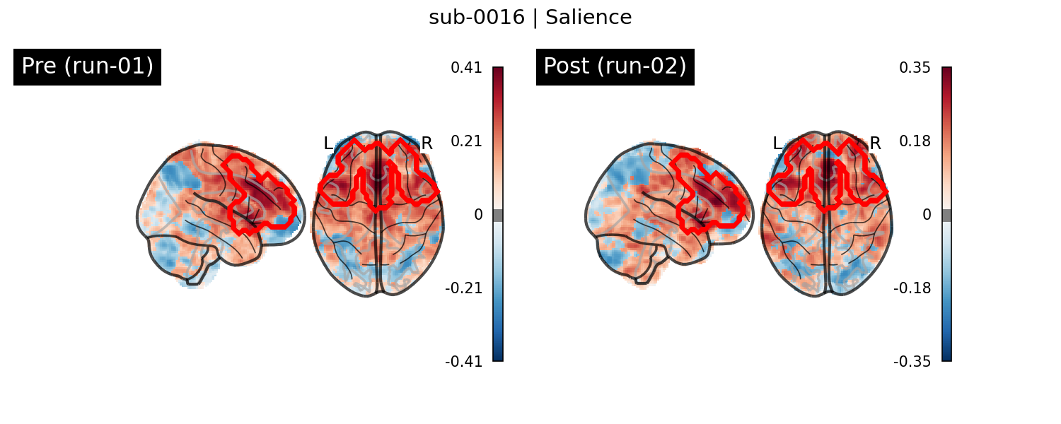 sub-0016_Salience_run-comparison.png