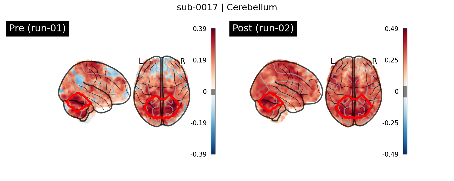 sub-0017_Cerebellum_run-comparison.png