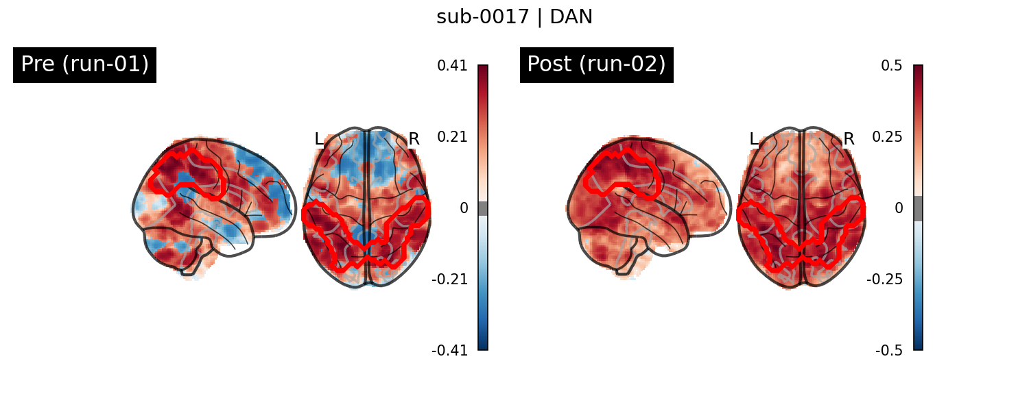 sub-0017_DAN_run-comparison.png