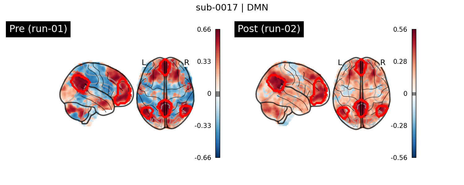 sub-0017_DMN_run-comparison.png